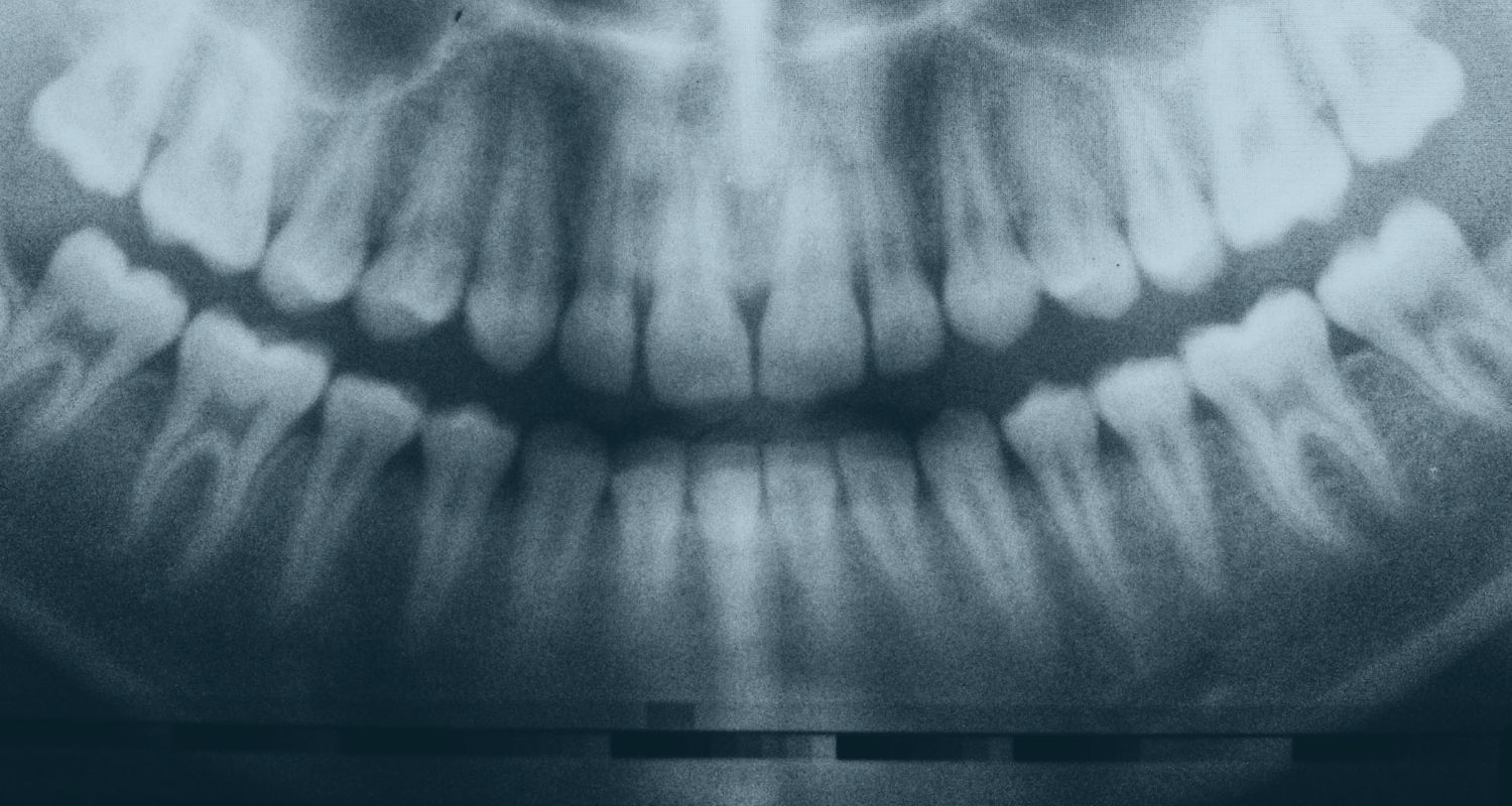 Dental Negligence Solicitors, expert legal support when dental treatment goes wrong